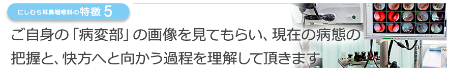 ご自身の病気の映像や画像を見てもらい説明や症状の経過を把握してもらいます