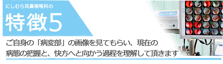 ご自身の病気の映像や画像を見てもらい説明や症状の経過を把握してもらいます